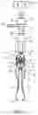 Fig. 04 - Surgical extractor