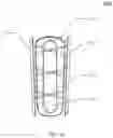 Fig. 04 - Splint and method for operating splint
