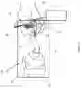 Fig. 07 - Device and Method for Controlled Motion of a Tool