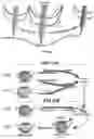 Fig. 10 - Apparatus for large scale additive manufacturing, and a material for manufacturing