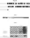 Fig. 06 - Codon-optimized reduced-size ATP7A CDNA and uses for treatment of copper transport disorders