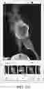 Fig. 09 - Auto-complete image suggestions for image editing