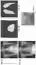 Fig. 08 - AUTOMATED SCREENING OF MEDICAL DATA