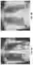 Fig. 09 - AUTOMATED SCREENING OF MEDICAL DATA