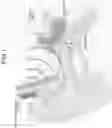 Fig. 02 - Bone conduction acoustic transmission device