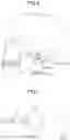 Fig. 07 - Bone conduction acoustic transmission device