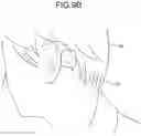 Fig. 09 - Bone conduction acoustic transmission device