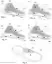 Fig. 02 - Sole and shoe with haptic feedback