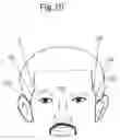 Fig. 07 - PERFECT HAIRLINER