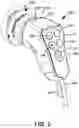 Fig. 03 - Endoscopic imaging and control systems and methods for use in diagnostic and therapeutic medical procedures