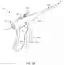 Fig. 05 - Endoscopic Surgical System