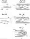 Fig. 06 - ENDOSCOPIC VESSEL HARVESTING SYSTEM COMPONENTS