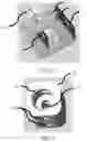 Fig. 09 - Apparatus and methods for measuring force required to remove contact lens from an eye