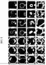 Fig. 09 - Method for classifying fundus image of subject and device using same