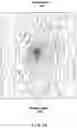 Fig. 25 - Methods and systems for optical imaging or epithelial luminal organs by beam scanning thereof