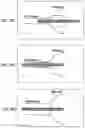 Fig. 31 - Methods and systems for optical imaging or epithelial luminal organs by beam scanning thereof