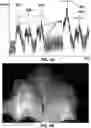 Fig. 05 - Methods and systems for obtaining physiologic information