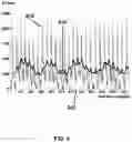 Fig. 07 - Methods and systems for obtaining physiologic information