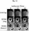 Fig. 12 - Synthetically trained neural network for MRI tag tracking