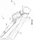 Fig. 09 - BIOLOGICAL FLUID COLLECTION SYSTEM AND STABILIZATION ASSEMBLY