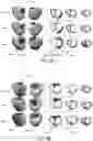 Fig. 06 - System and method for temporal sparse promoting imaging of cardiac activation