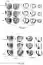 Fig. 07 - System and method for temporal sparse promoting imaging of cardiac activation