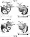 Fig. 09 - Systems and methods for noninvasive spectral-spatiotemporal imaging of cardiac electrical activity