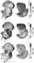 Fig. 10 - Systems and methods for noninvasive spectral-spatiotemporal imaging of cardiac electrical activity