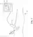 Fig. 02 - Ultrasound system for enhanced instrument visualization