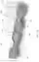Fig. 33 - Packaging for surgical implant