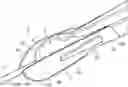 Fig. 01 - Surgical instruments
