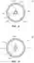 Fig. 09 - LITHOPLASTY DEVICE WITH ADVANCING ENERGY WAVEFRONT