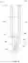 Fig. 06 - Biopsy marker with anchoring capabilities