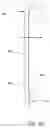 Fig. 12 - Biopsy marker with anchoring capabilities