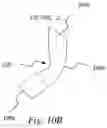 Fig. 26 - Biopsy marker with anchoring capabilities