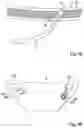 Fig. 05 - Device for the external support of the female urethra under stress