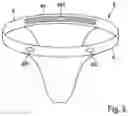 Fig. 06 - Device for the external support of the female urethra under stress