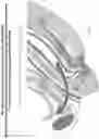 Fig. 09 - Device for the external support of the female urethra under stress