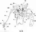 Fig. 07 - CATHETER FOR PREVENTION OF STROKE AND METHOD OF USE