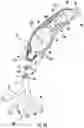 Fig. 22 - CATHETER FOR PREVENTION OF STROKE AND METHOD OF USE
