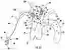 Fig. 41 - CATHETER FOR PREVENTION OF STROKE AND METHOD OF USE