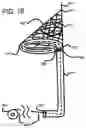 Fig. 23 - Endovascular device with expandable filter