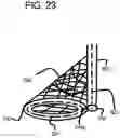 Fig. 28 - Endovascular device with expandable filter
