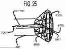 Fig. 30 - Endovascular device with expandable filter