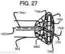 Fig. 32 - Endovascular device with expandable filter