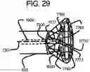Fig. 34 - Endovascular device with expandable filter