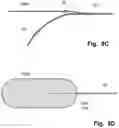 Fig. 09 - Device For Filtering Embolic Material In A Vascular System