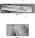 Fig. 08 - Connective tissue to bone interface scaffolds