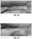 Fig. 09 - Connective tissue to bone interface scaffolds