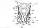 Fig. 01 - Sinus-engaging valve fixation member